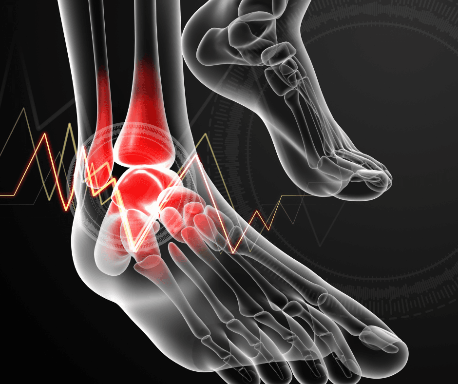 Ankle and Foot Pain