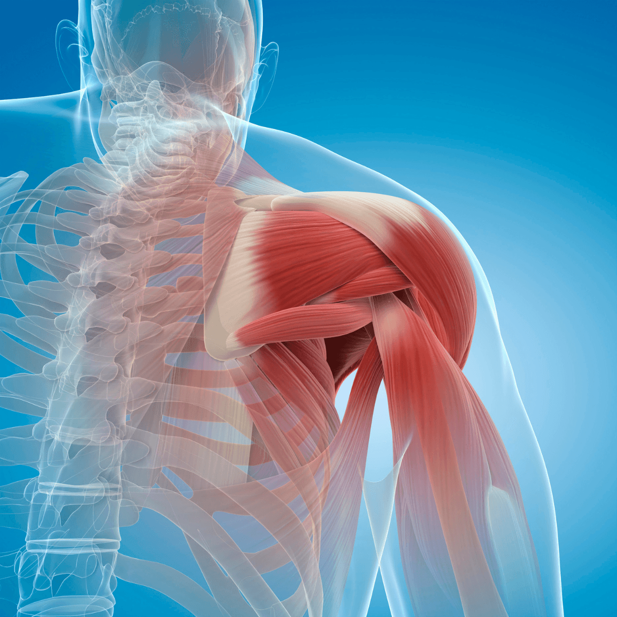 Rotator Cuff Tear